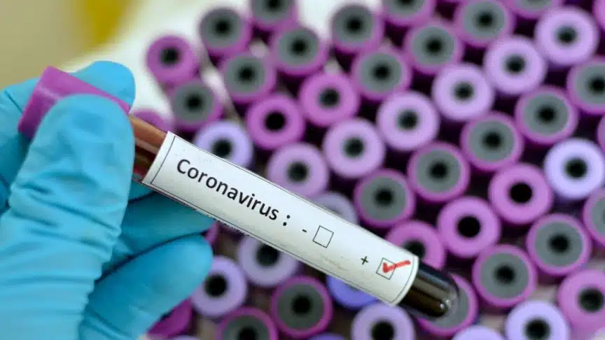 Coronavirus will slow the US economy